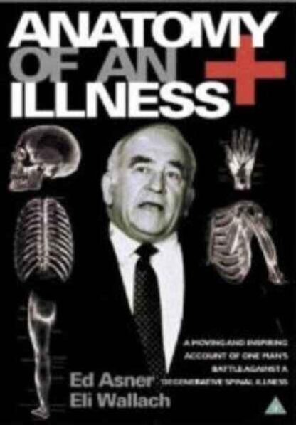 Anatomy of an Illness (1984) Starring Edward Asner on DVD - Image 3