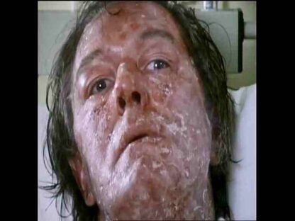 The Singing Detective (1986) Starring Michael Gambon on DVD - Image 2